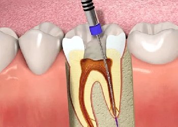 Cosmetic Dentistry in Madurai